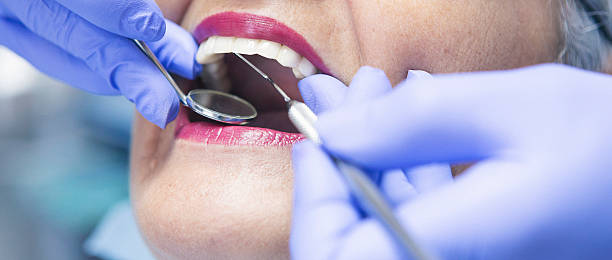 Best Emergency Root Canal Therapy in Pierre, SD